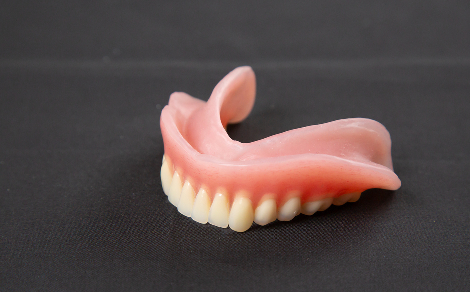 レジン床義歯