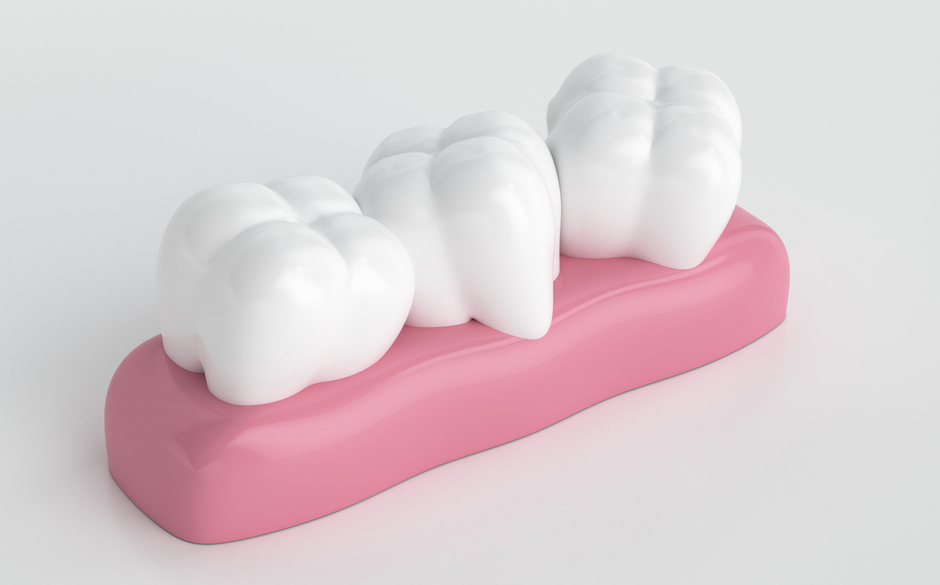 きれいな歯並びで笑顔に自信を