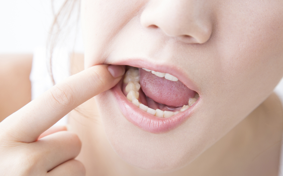 早期発見・早期治療で大切な歯を守る