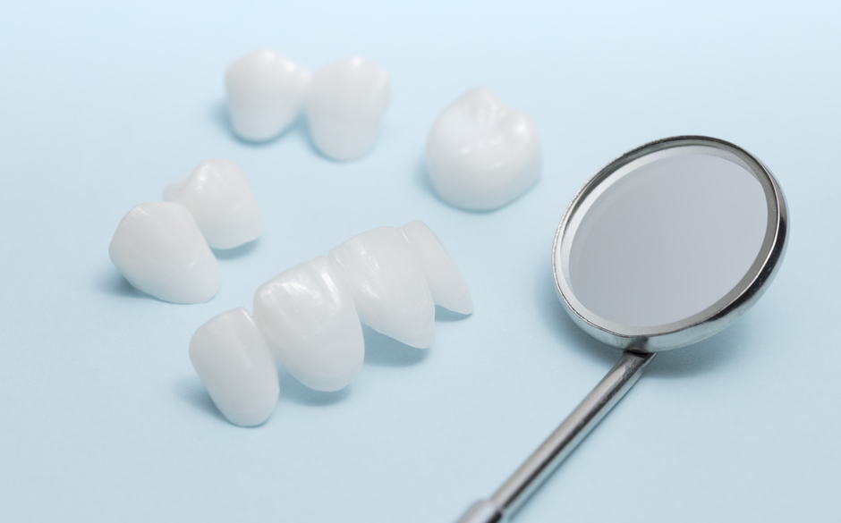 金属アレルギーのリスクの軽減